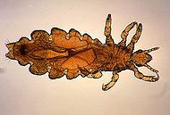 pedicullosis.jpg